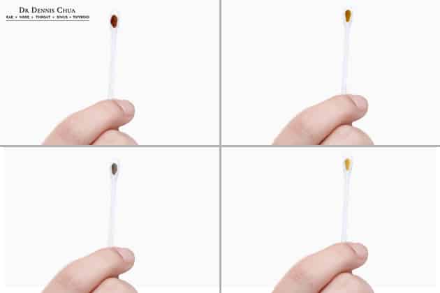 Different Colors of Earwax