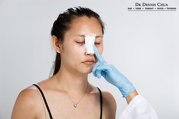 Conditions that may Warrant Rhinoplasty in Singapore