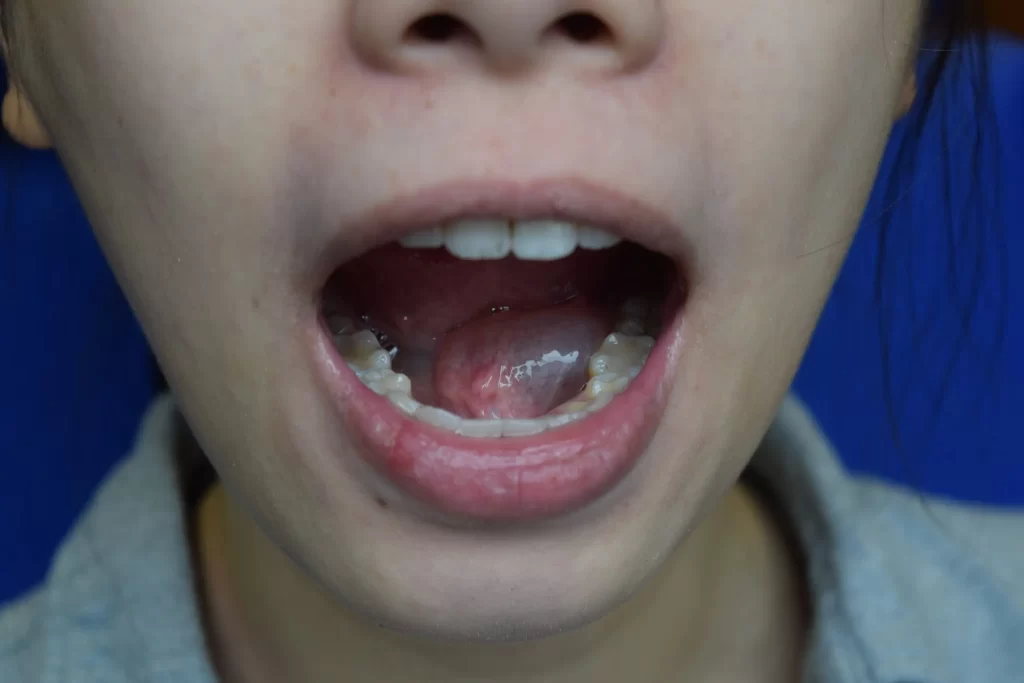 Close-up of a nose and open mouth with a blurred background