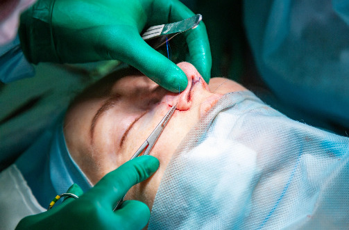 Surgeon performing a delicate procedure on patient nose